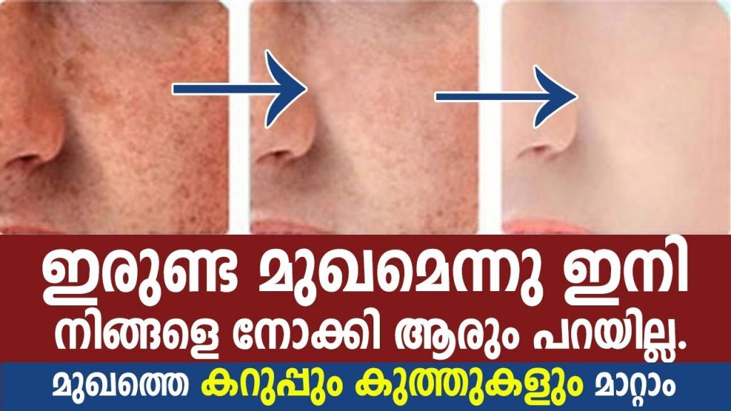 Black spot on face best 5 reason