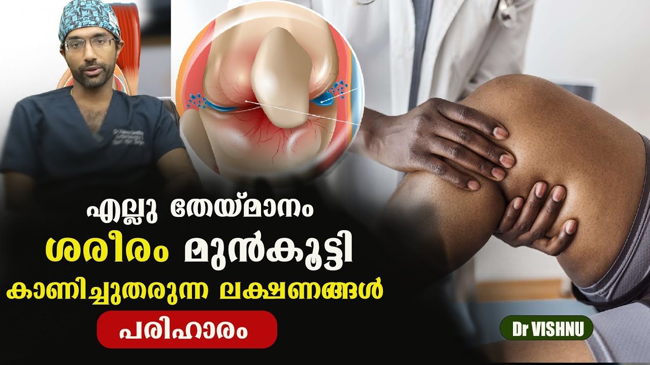 എല്ല് തേയ്മാനം പരിഹരിച്ചു ആരോഗ്യം സംരക്ഷിക്കാൻ…| Bone wear Remedies