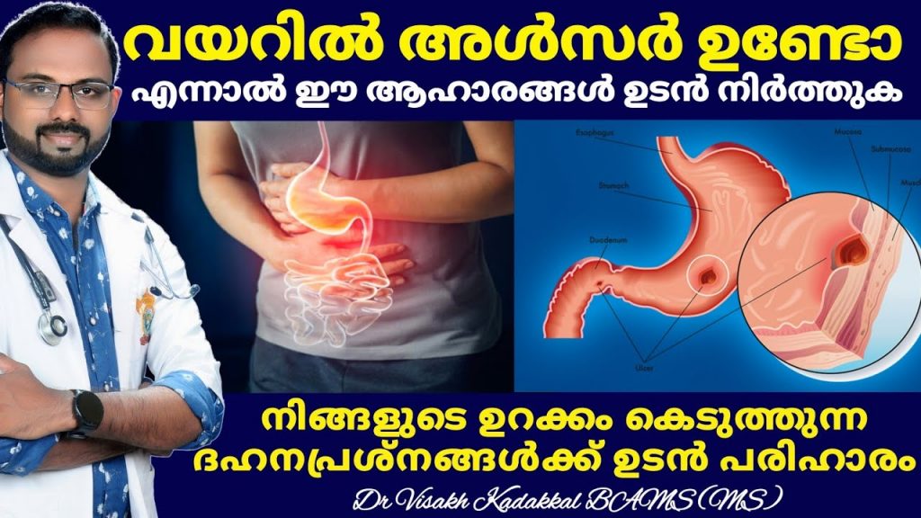 Fastest way to cure a stomach ulcer