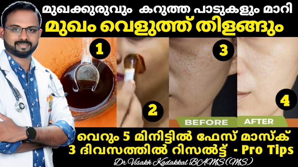 Skin whitening home remedies