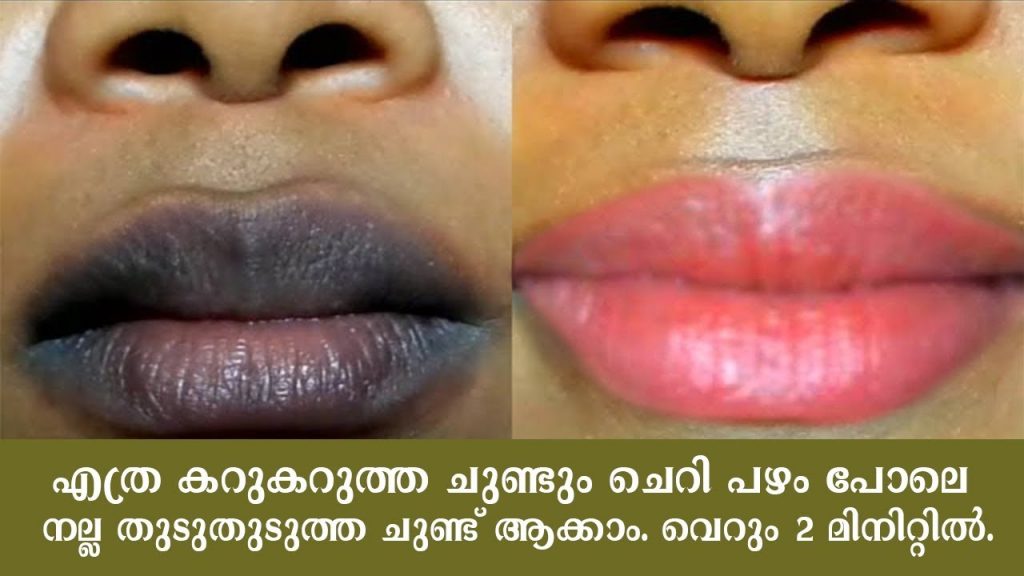 Remove darkness in lips