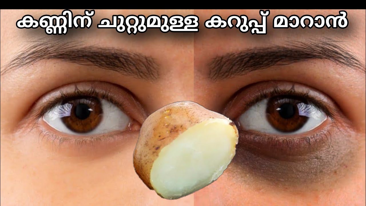 To remove dark circles under the eyes