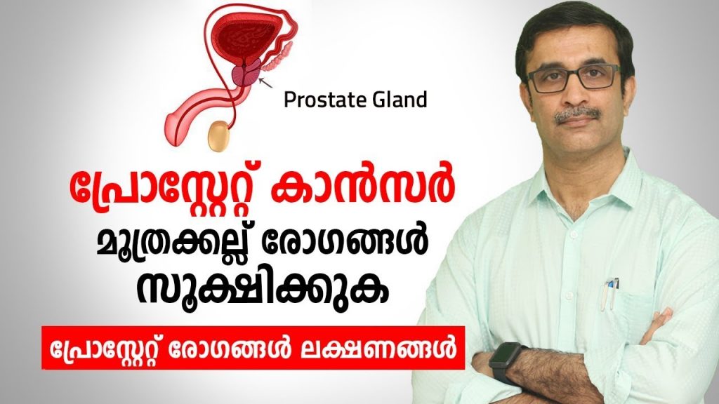 Prostate Cancer and Kidney Stone