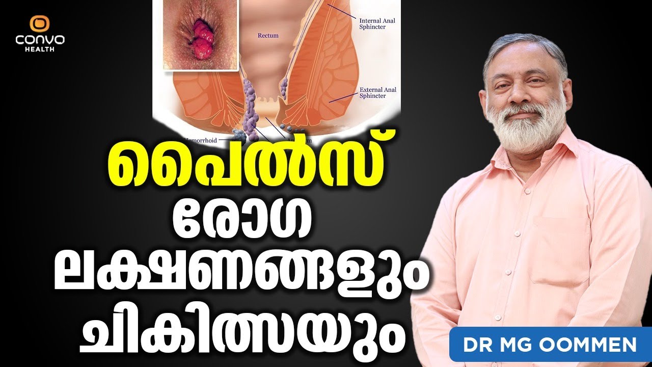 Piles treatment malayalam