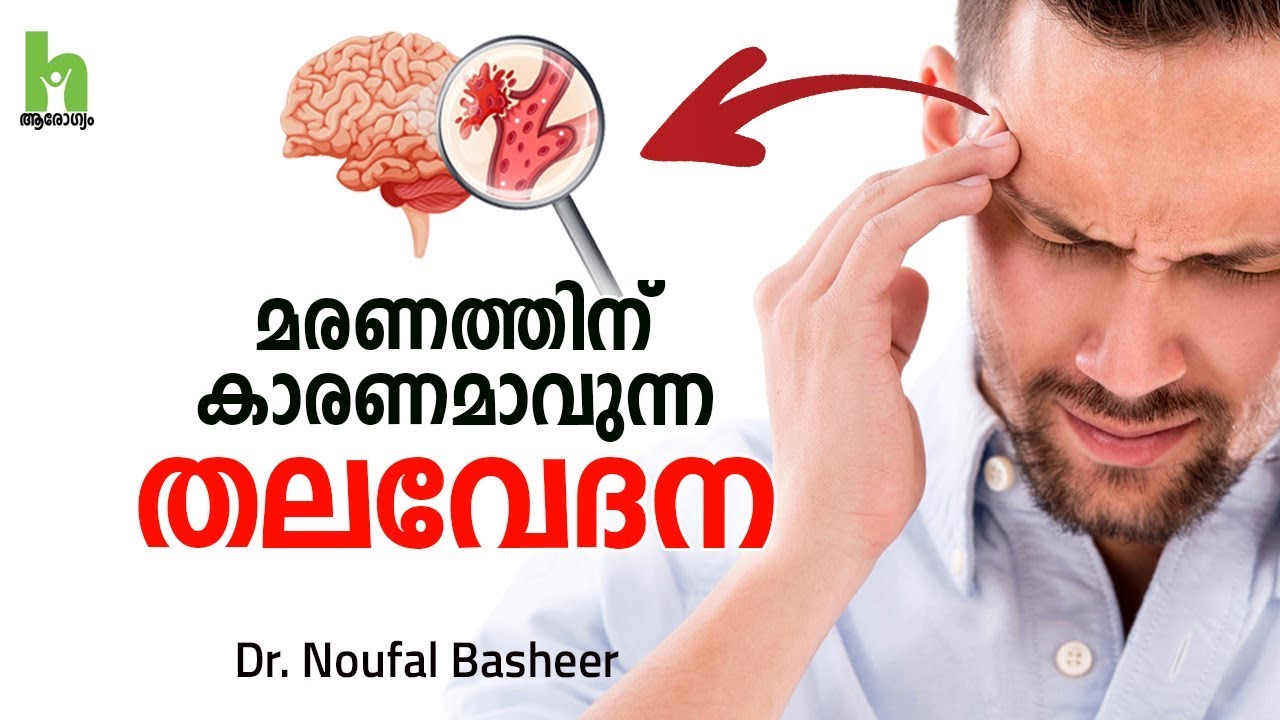 A thunderclap headache can cause death