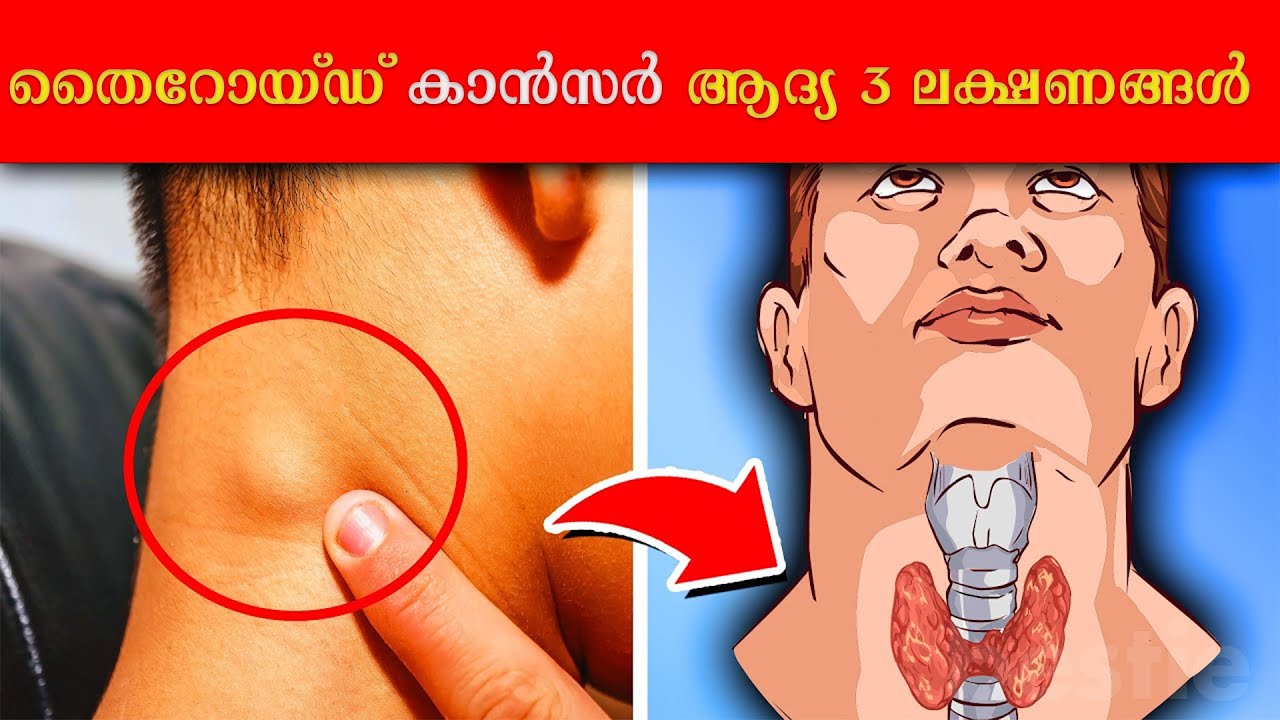 These throat changes are not trivial at all, don’t ignore these symptoms…